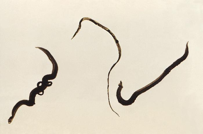 Salvensis Schistosomiasis